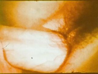 The XX Series 10: East Meets West